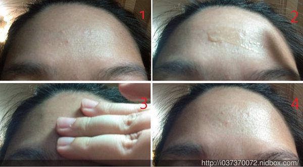 AMIINO安美諾高效抗痘凝膠