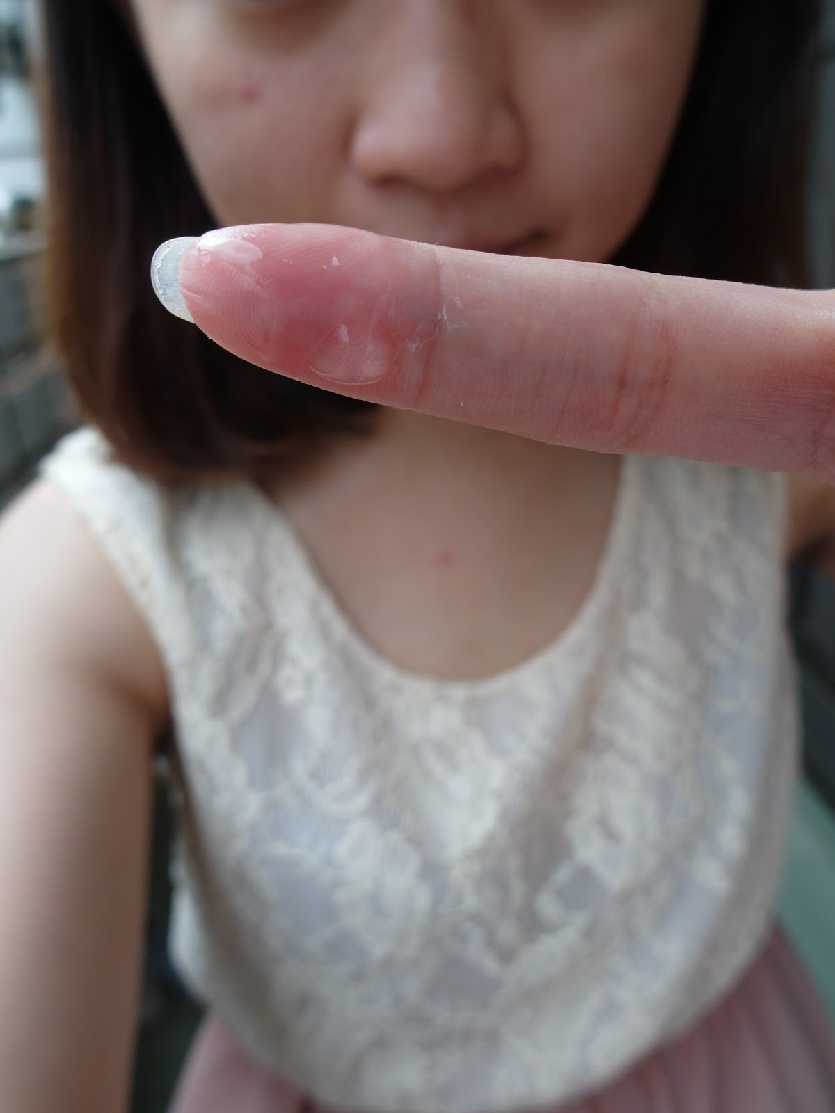 AMIINO安美諾高效抗痘凝膠