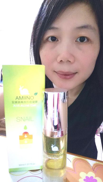 AMIINO安美諾高效抗痘凝膠