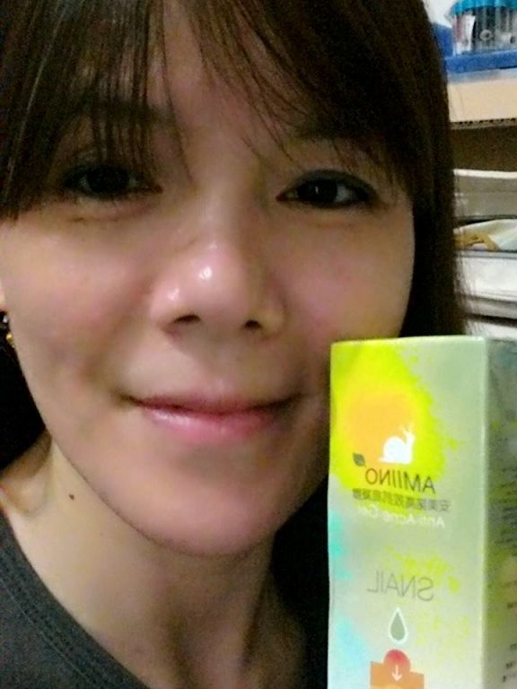 AMIINO安美諾高效抗痘凝膠