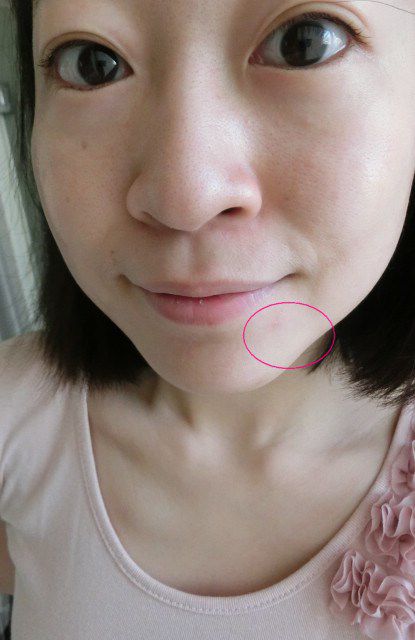 AMIINO安美諾高效抗痘凝膠