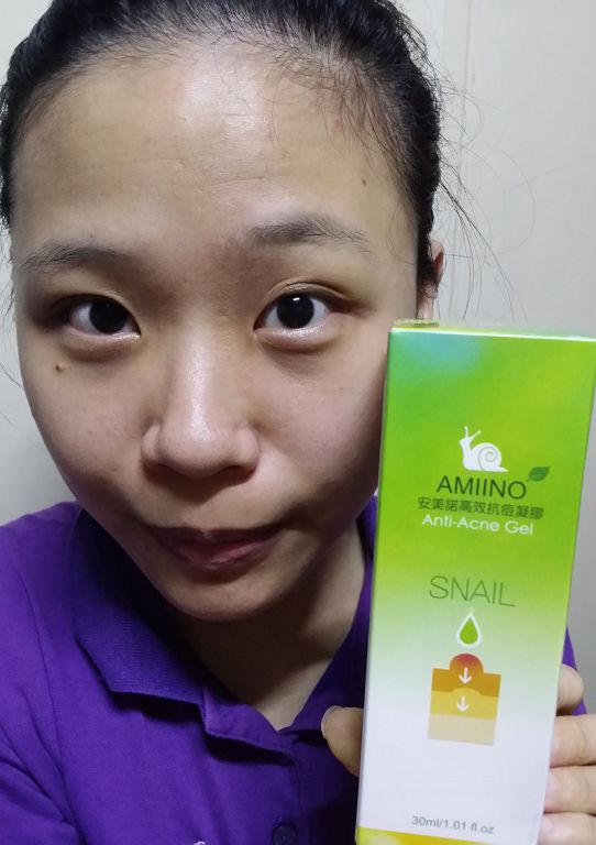 AMIINO安美諾高效抗痘凝膠