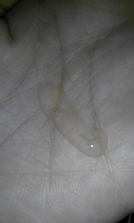 AMIINO安美諾高效抗痘凝膠