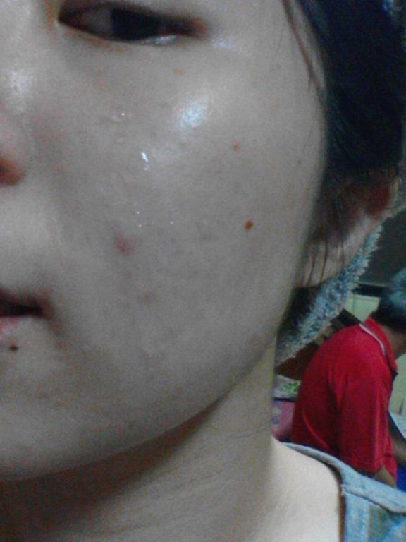 AMIINO安美諾高效抗痘凝膠