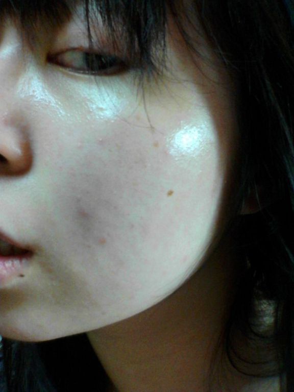 AMIINO安美諾高效抗痘凝膠