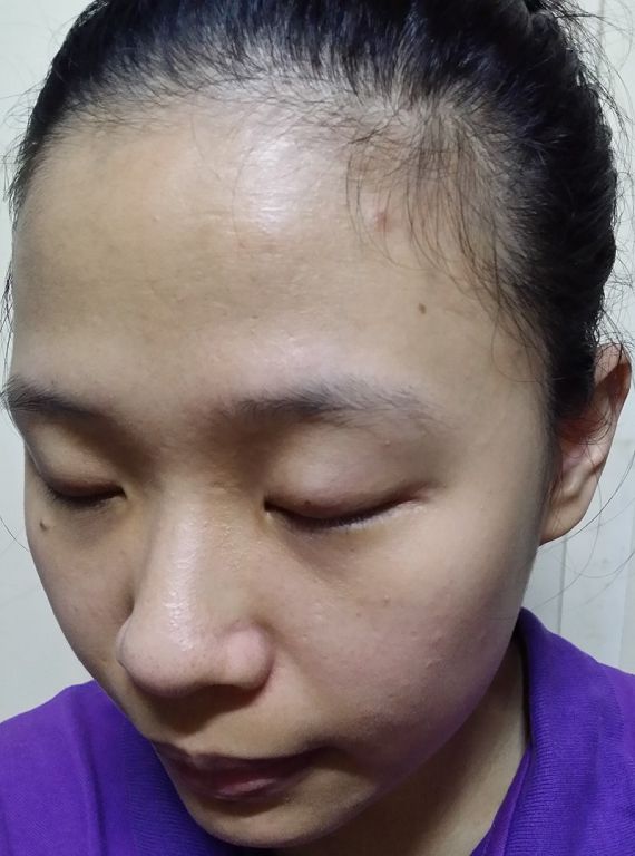 AMIINO安美諾高效抗痘凝膠