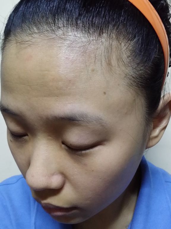 AMIINO安美諾高效抗痘凝膠