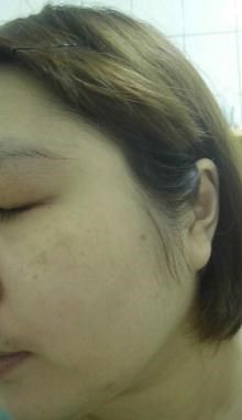 AMIINO安美諾高效抗痘凝膠