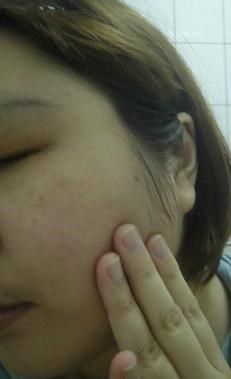 AMIINO安美諾高效抗痘凝膠