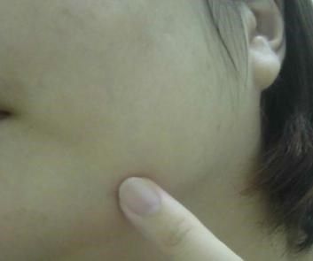 AMIINO安美諾高效抗痘凝膠