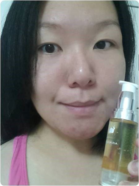 AMIINO安美諾高效抗痘凝膠