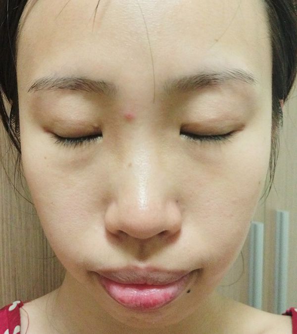 AMIINO安美諾高效抗痘凝膠