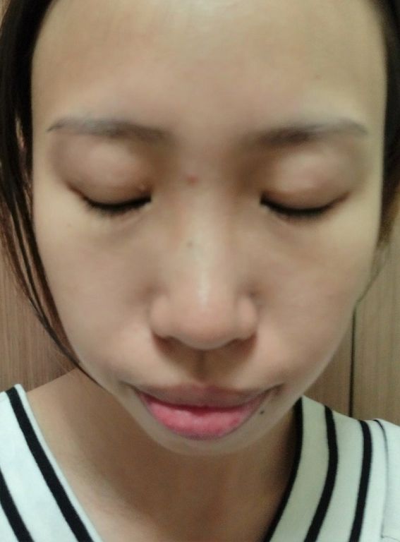 AMIINO安美諾高效抗痘凝膠