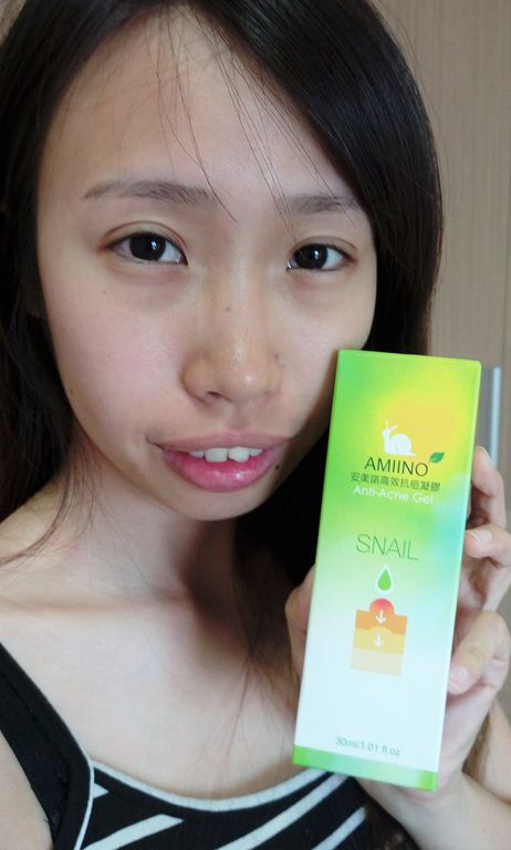 AMIINO安美諾高效抗痘凝膠