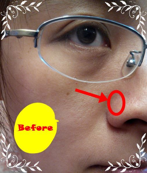 AMIINO安美諾高效抗痘凝膠