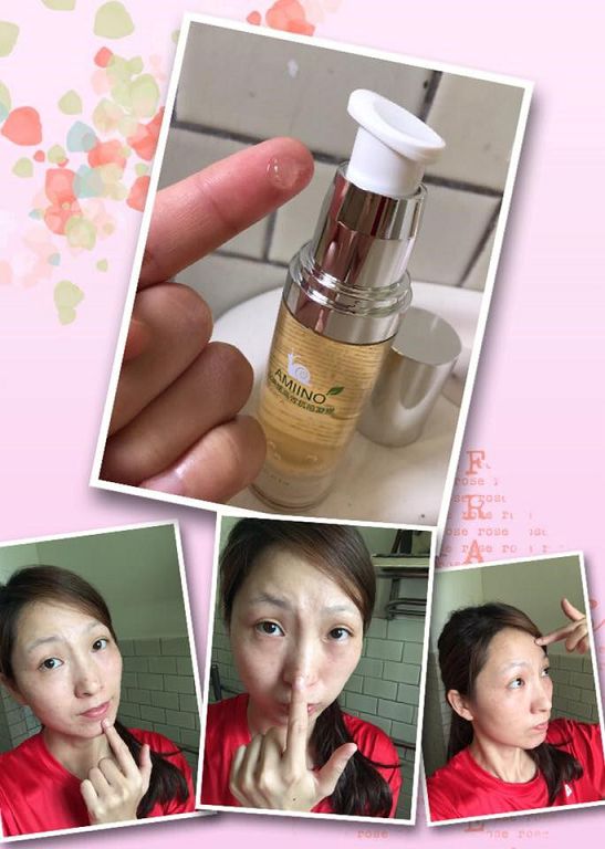 AMIINO安美諾高效抗痘凝膠