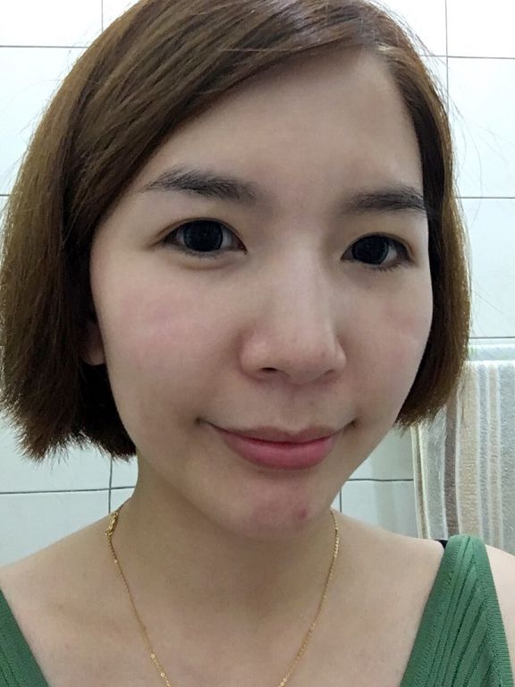 AMIINO安美諾高效抗痘凝膠