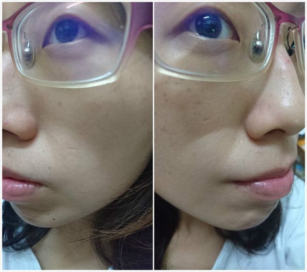 AMIINO安美諾高效抗痘凝膠