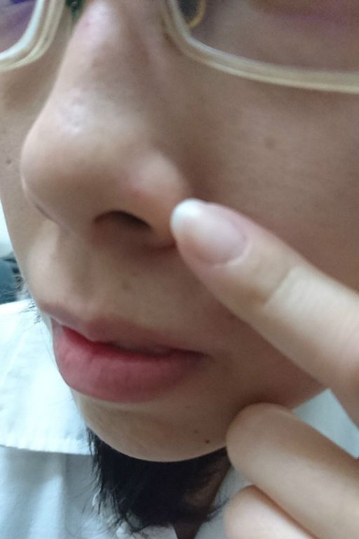 AMIINO安美諾高效抗痘凝膠