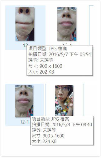 AMIINO安美諾高效抗痘凝膠