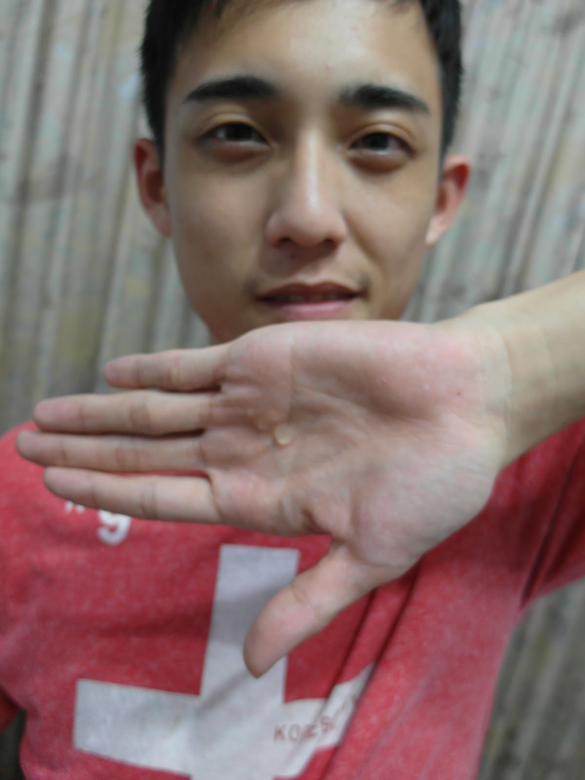 AMIINO安美諾高效抗痘凝膠