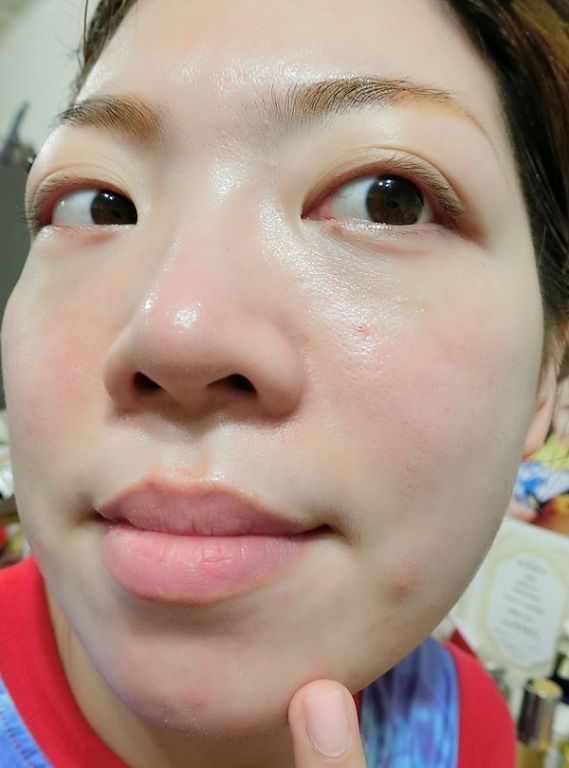 AMIINO安美諾高效抗痘凝膠