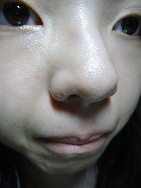 AMIINO安美諾高效抗痘凝膠