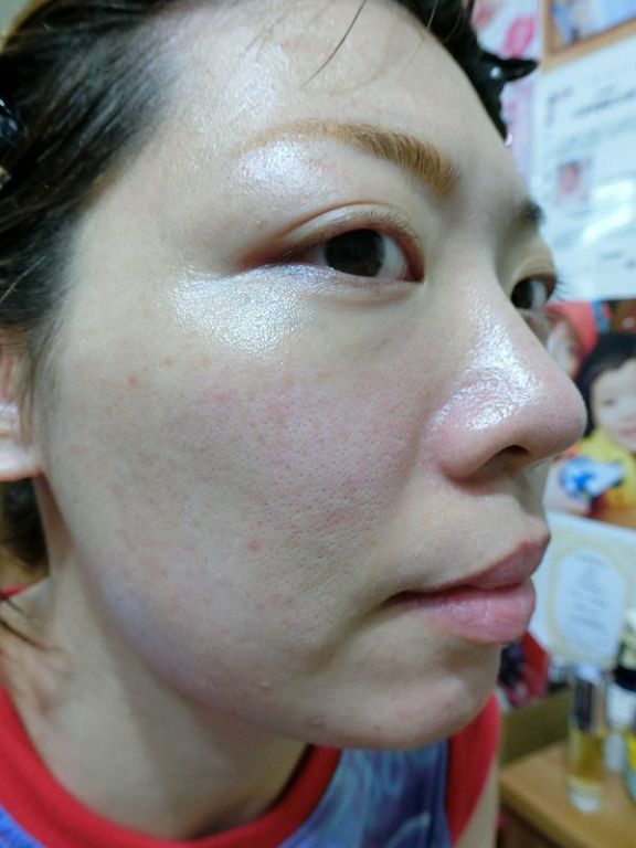 AMIINO安美諾高效抗痘凝膠