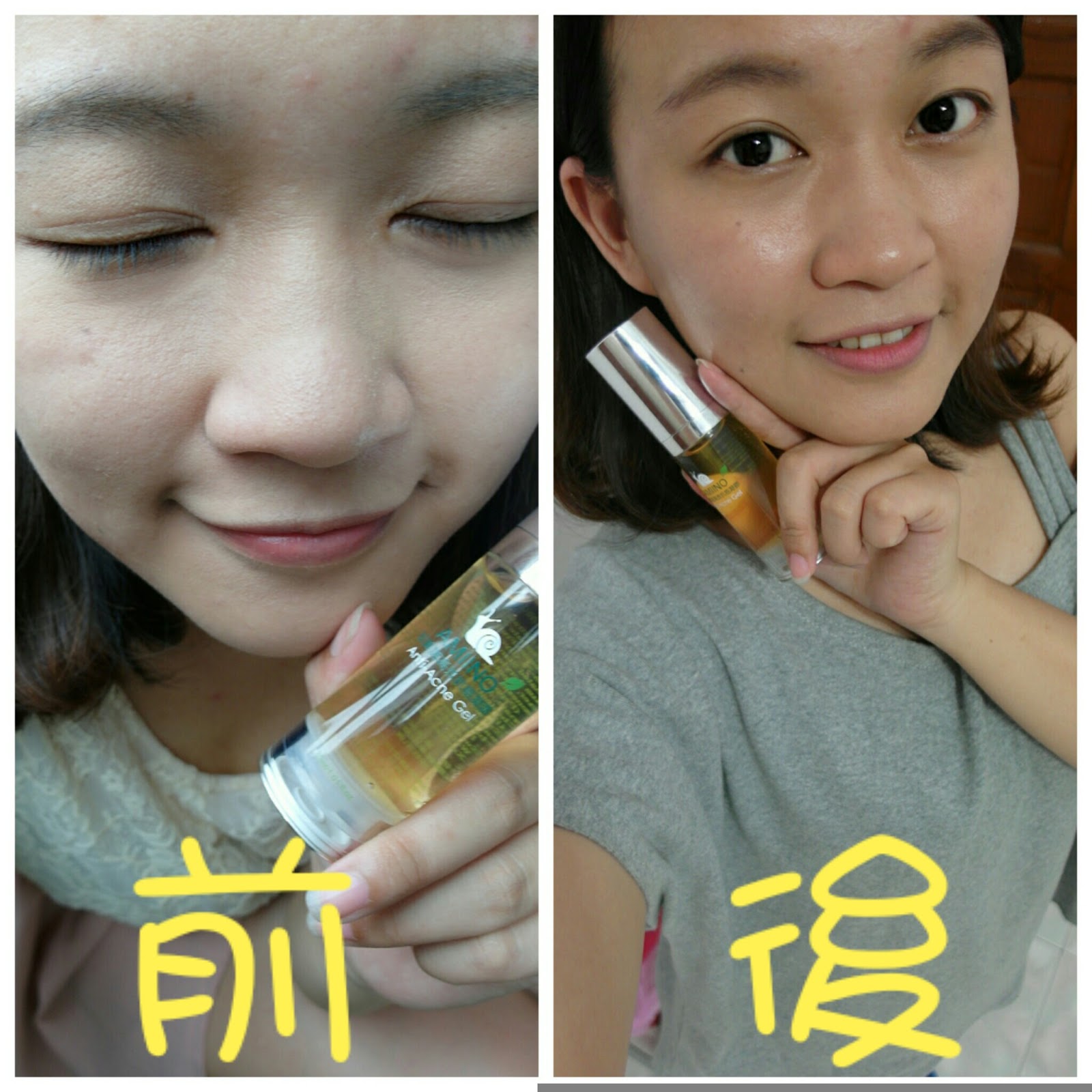 AMIINO安美諾高效抗痘凝膠