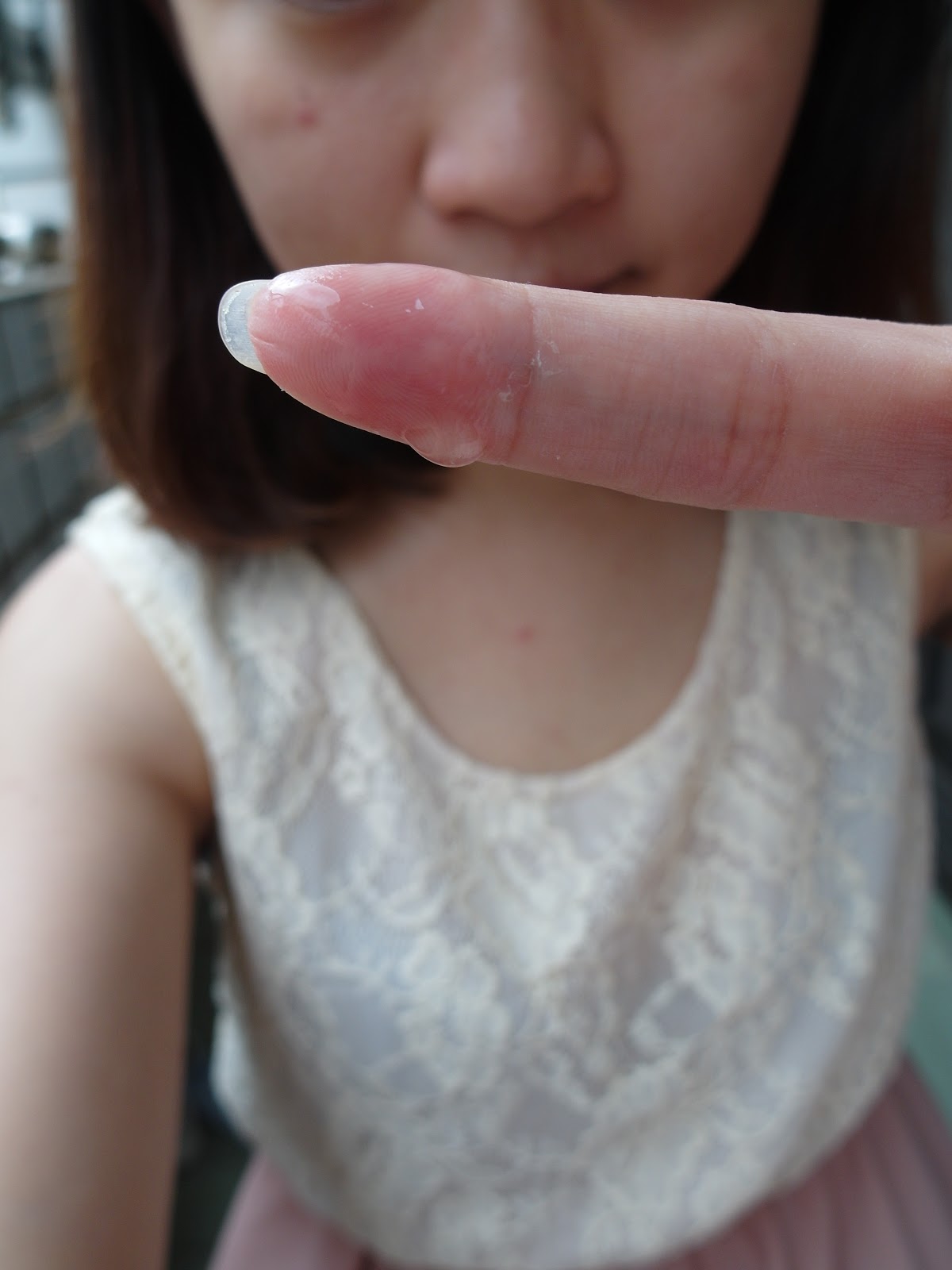 AMIINO安美諾高效抗痘凝膠