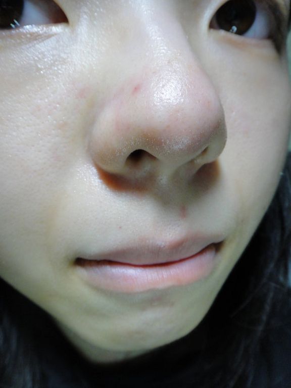 AMIINO安美諾高效抗痘凝膠