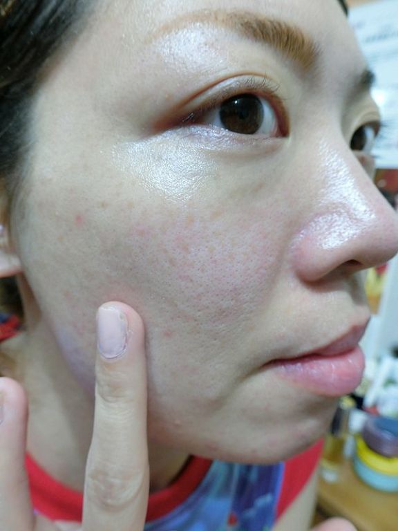 AMIINO安美諾高效抗痘凝膠