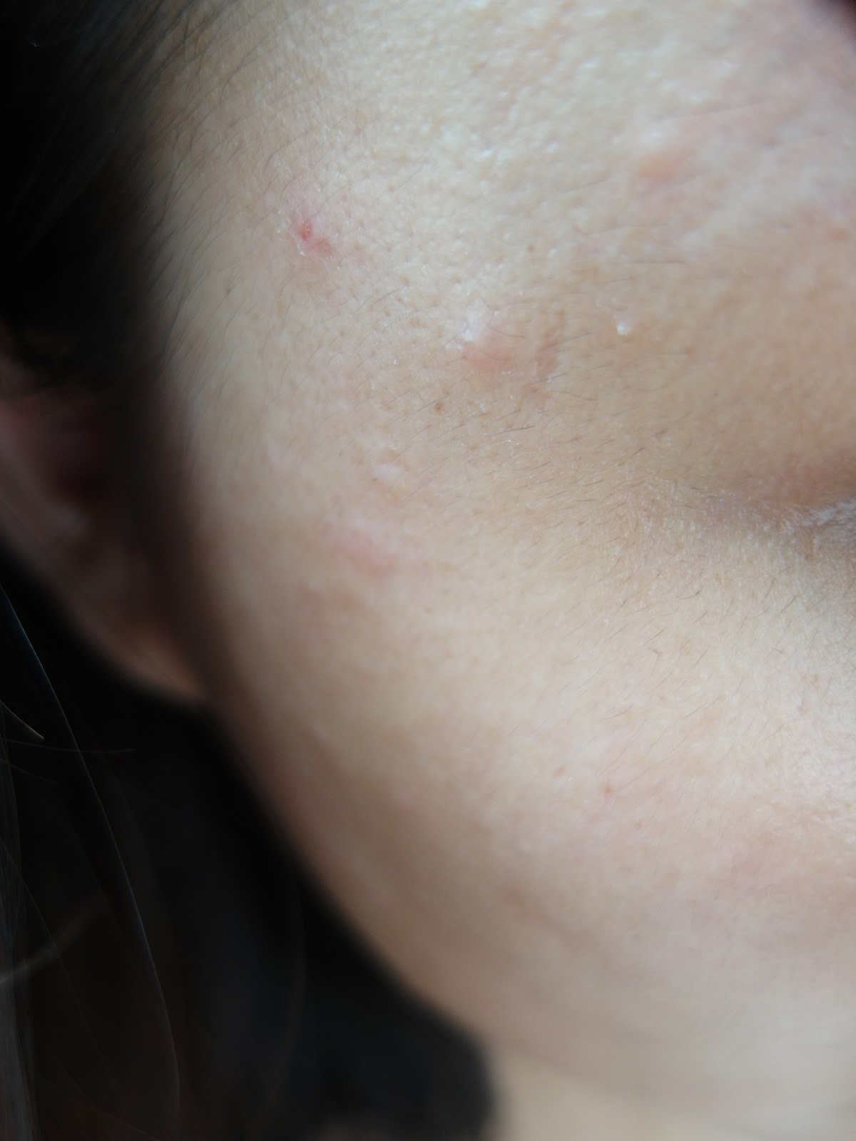 AMIINO安美諾高效抗痘凝膠