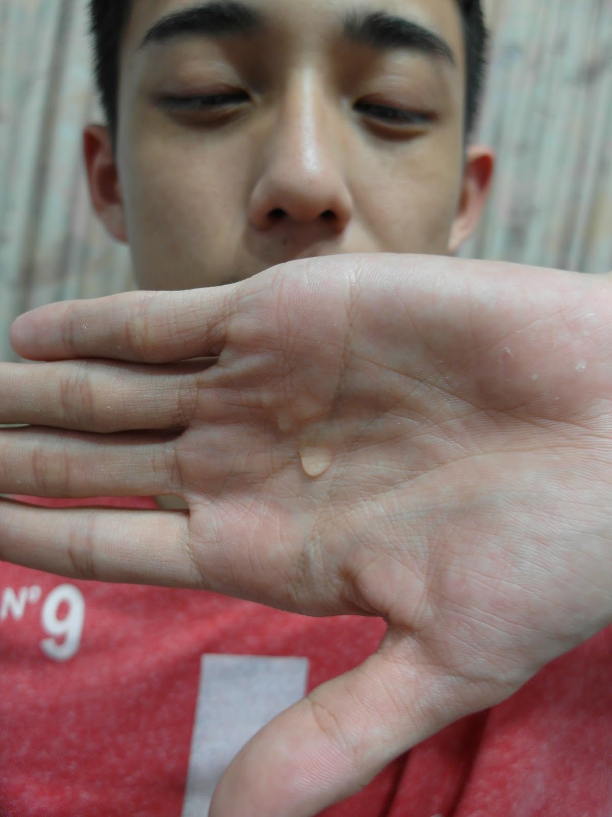 AMIINO安美諾高效抗痘凝膠