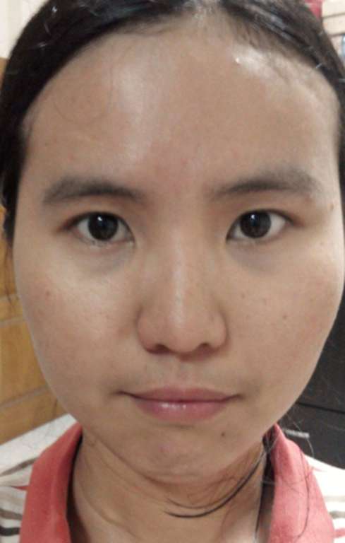 macy熊果素修護淨白面膜