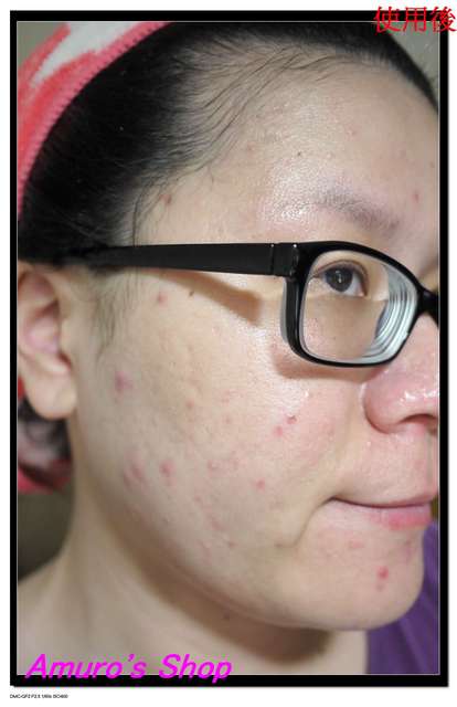 蓓亞B.yar蝸牛保濕抗皺面膜