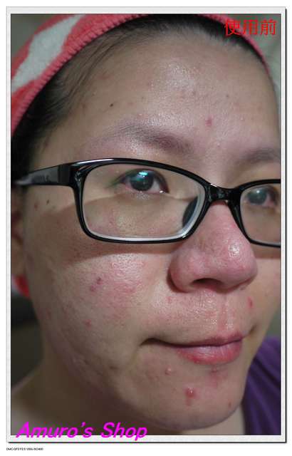 蓓亞B.yar蝸牛保濕抗皺面膜