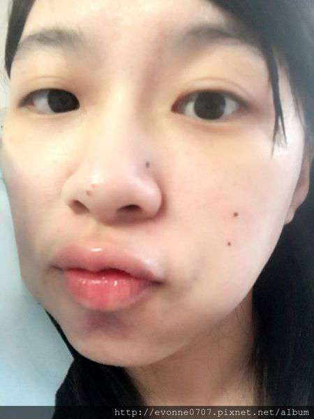 蓓亞B.yar蝸牛保濕抗皺面膜