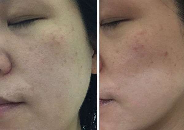 蓓亞B.yar蝸牛保濕抗皺面膜