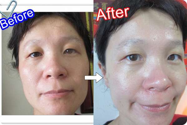 蓓亞B.yar蝸牛保濕抗皺面膜