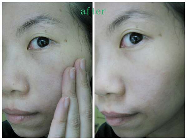 蓓亞B.yar蝸牛保濕抗皺面膜