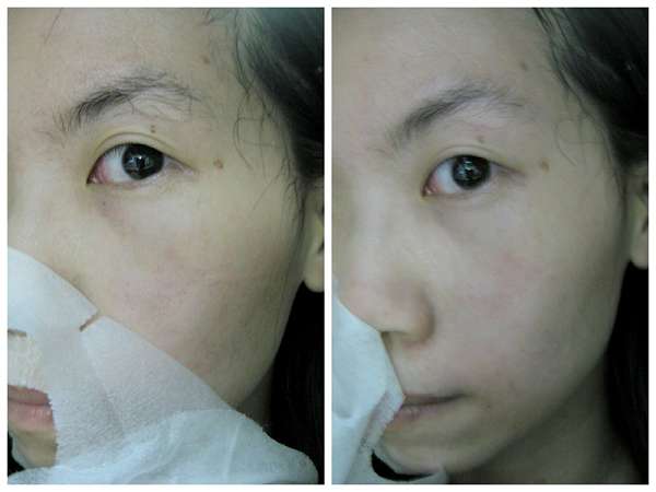 蓓亞B.yar蝸牛保濕抗皺面膜