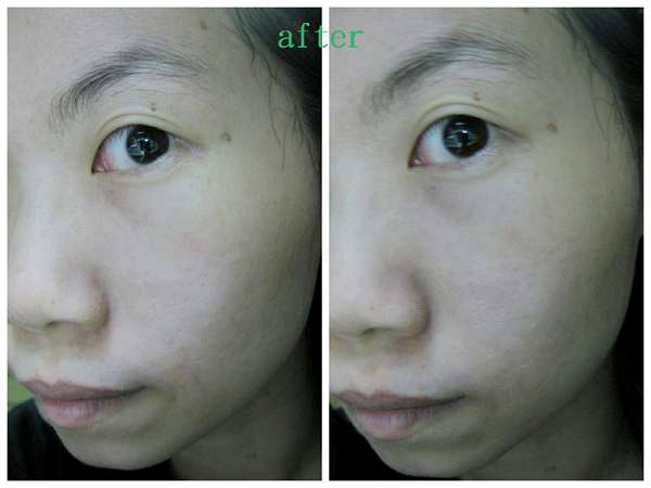 蓓亞B.yar蝸牛保濕抗皺面膜