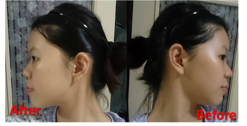 蓓亞B.yar蝸牛保濕抗皺面膜