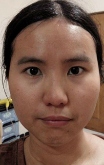 蓓亞B.yar蝸牛保濕抗皺面膜