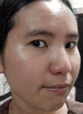 蓓亞B.yar蝸牛保濕抗皺面膜