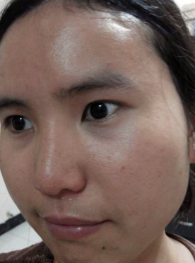 蓓亞B.yar蝸牛保濕抗皺面膜