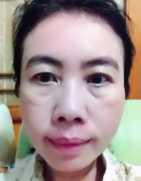 蓓亞B.yar蝸牛保濕抗皺面膜